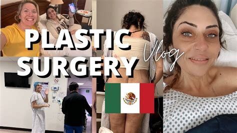 tummy tuck cost in tijuana|Tummy Tuck in Tijuana – Mexico